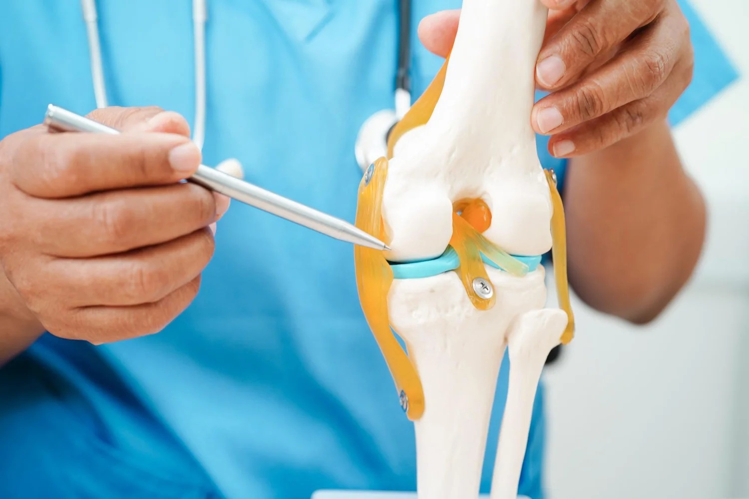 Diz Osteoartritinde Adjuvan Cerrahi Olmadan Mezenkimal Kök Hücrelerinin Eklem İçi Enjeksiyonu